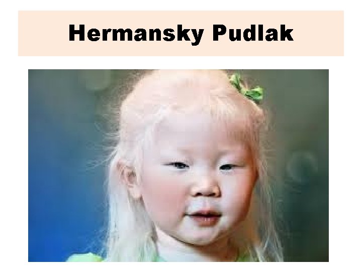 Hermansky Pudlak 