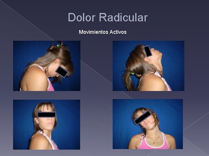 Dolor Radicular Movimientos Activos 