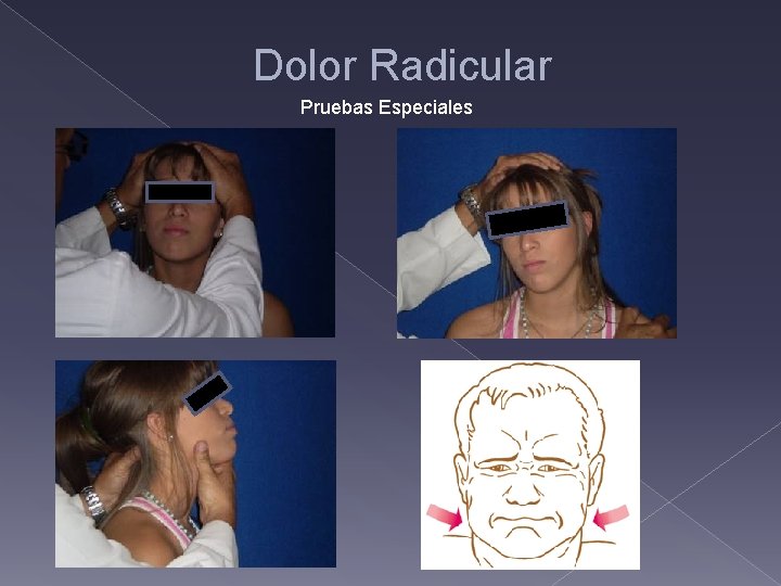 Dolor Radicular Pruebas Especiales 