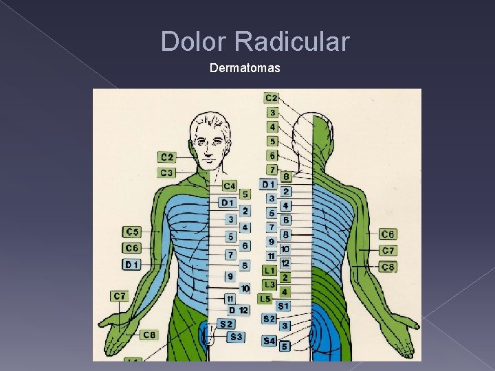 Dolor Radicular Dermatomas 