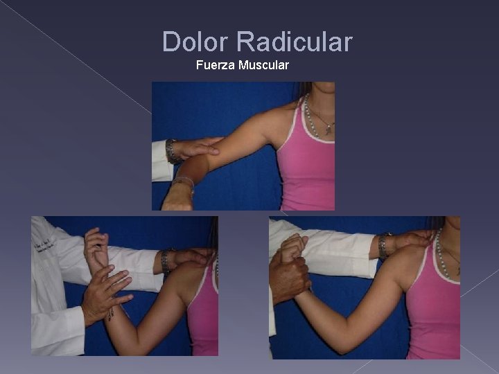 Dolor Radicular Fuerza Muscular 