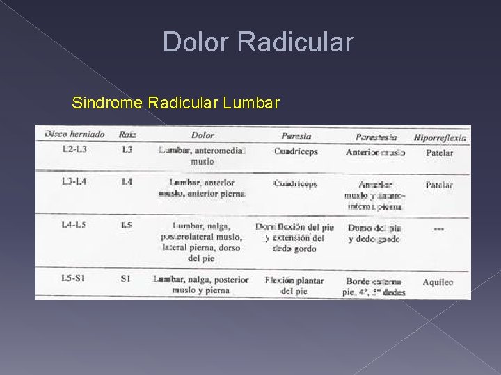 Dolor Radicular Sindrome Radicular Lumbar 
