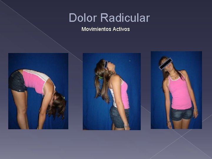 Dolor Radicular Movimientos Activos 