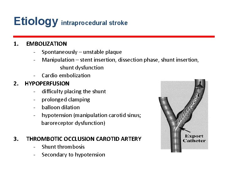 Etiology intraprocedural stroke 1. EMBOLIZATION - Spontaneously – unstable plaque - Manipulation – stent