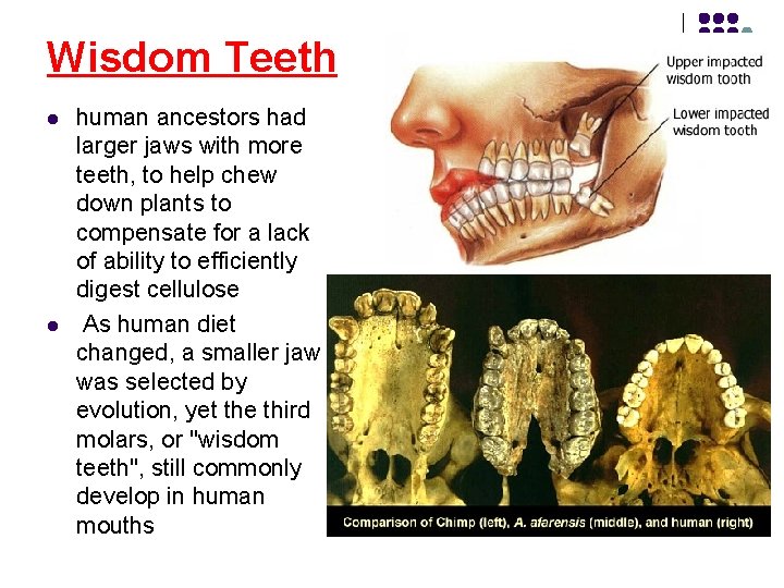Wisdom Teeth l l human ancestors had larger jaws with more teeth, to help Wisdom Teeth l l human ancestors had larger jaws with more teeth, to help