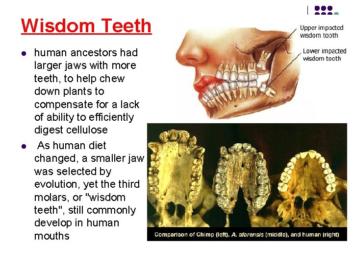 Wisdom Teeth l l human ancestors had larger jaws with more teeth, to help
