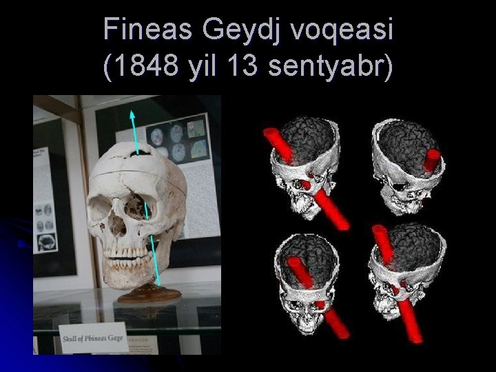 Fineas Geydj voqeasi (1848 yil 13 sentyabr) 