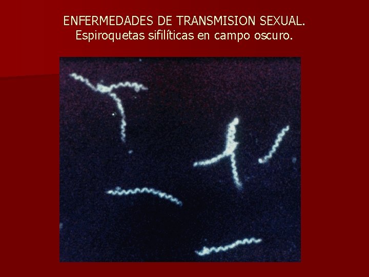 ENFERMEDADES DE TRANSMISION SEXUAL. Espiroquetas sifilíticas en campo oscuro. 