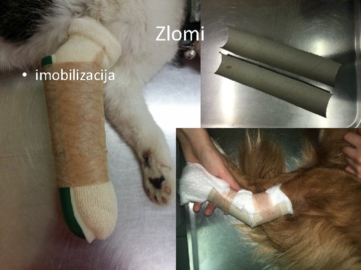 Zlomi • imobilizacija 
