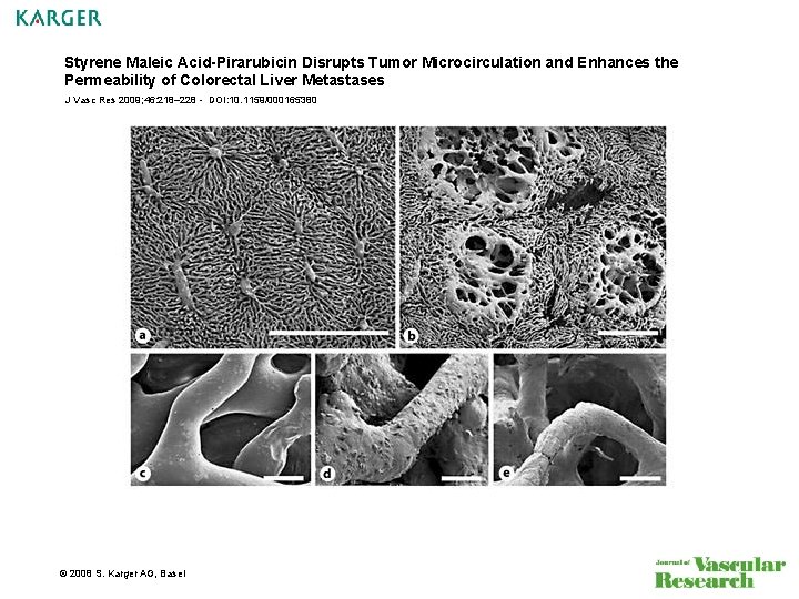 Styrene Maleic Acid-Pirarubicin Disrupts Tumor Microcirculation and Enhances the Permeability of Colorectal Liver Metastases