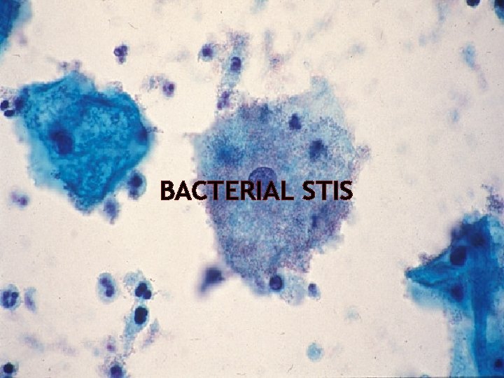 BACTERIAL STIS 