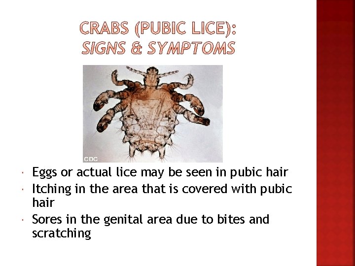  Eggs or actual lice may be seen in pubic hair Itching in the