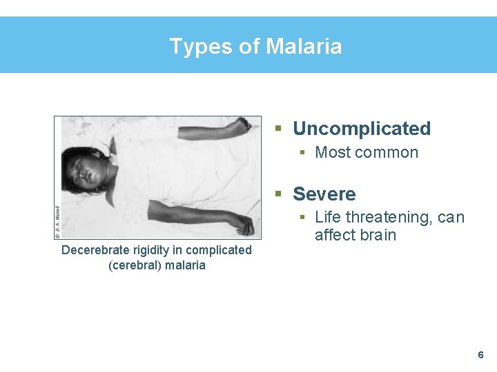 Types of Malaria § Uncomplicated § Most common § Severe § Life threatening, can