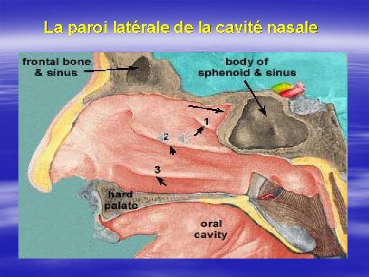 La paroi latérale de la cavité nasale 