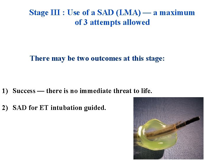 Stage III : Use of a SAD (LMA) — a maximum of 3 attempts