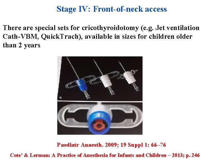 Stage IV: Front-of-neck access There are special sets for cricothyroidotomy (e. g. Jet ventilation