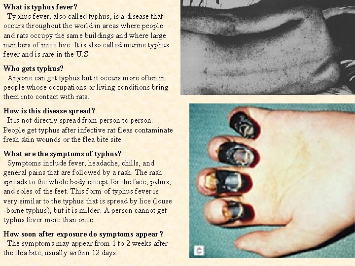 What is typhus fever? Typhus fever, also called typhus, is a disease that occurs