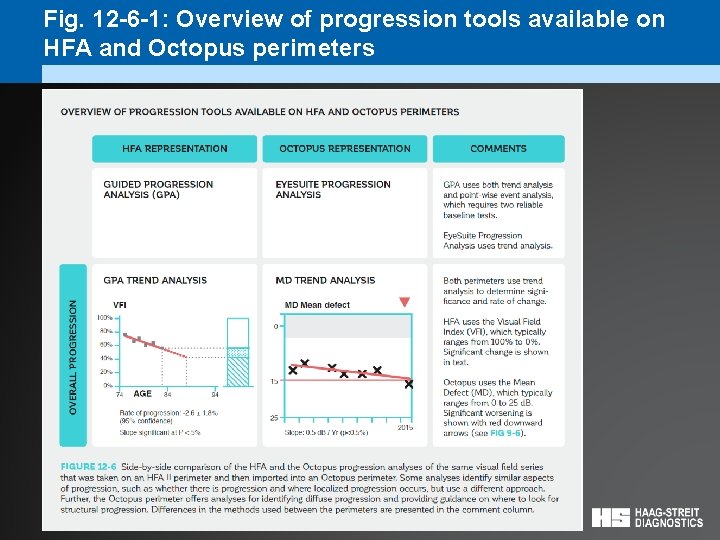 Fig. 12 -6 -1: Overview of progression tools available on HFA and Octopus perimeters