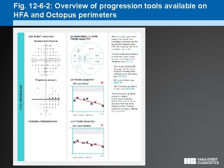 Fig. 12 -6 -2: Overview of progression tools available on HFA and Octopus perimeters