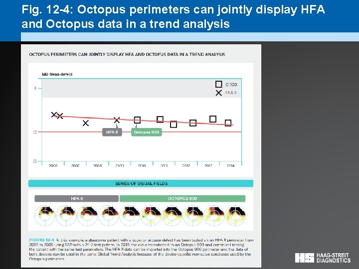 Fig. 12 -4: Octopus perimeters can jointly display HFA and Octopus data in a
