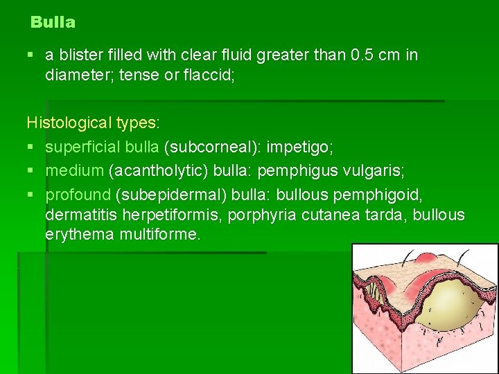 Bulla § a blister filled with clear fluid greater than 0. 5 cm in