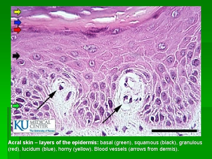 Acral skin – layers of the epidermis: basal (green), squamous (black), granulous (red), lucidum
