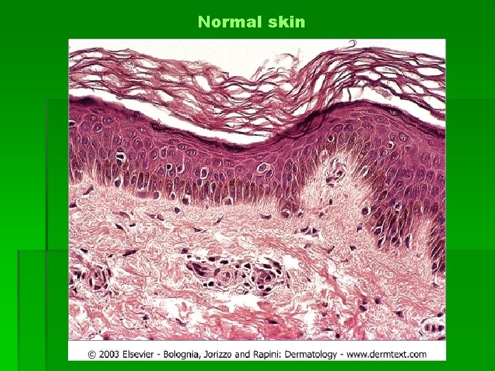 Normal skin 