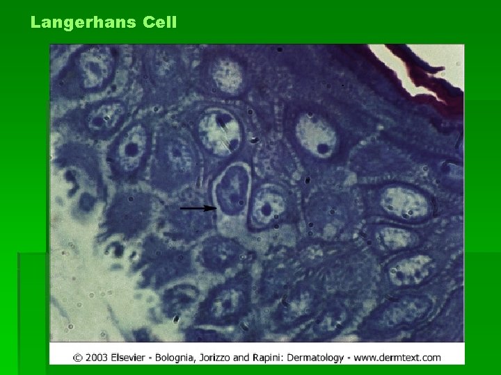 Langerhans Cell 