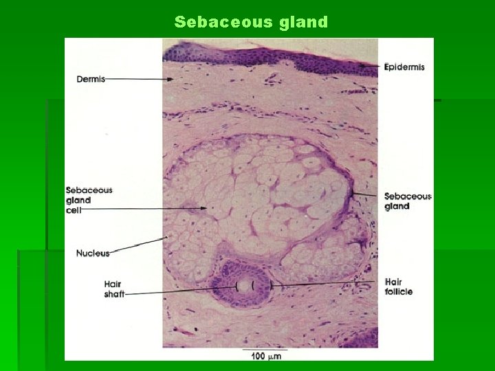 Sebaceous gland 
