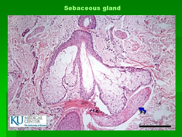 Sebaceous gland 