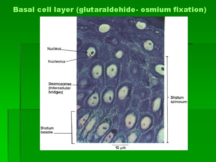 Basal cell layer (glutaraldehide- osmium fixation) 