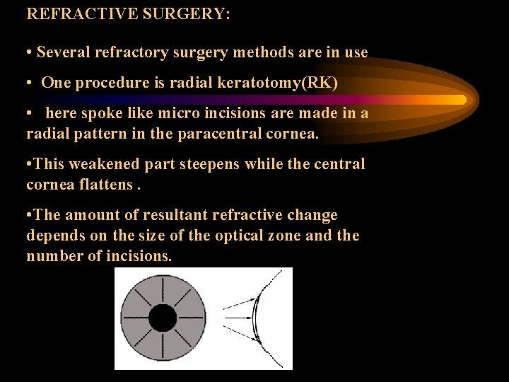 REFRACTIVE SURGERY: • Several refractory surgery methods are in use • One procedure is