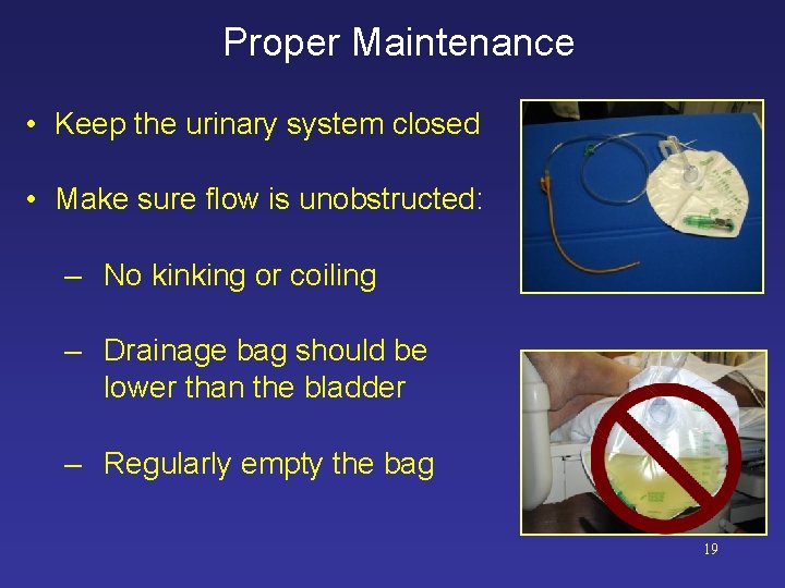 Proper Maintenance • Keep the urinary system closed • Make sure flow is unobstructed: