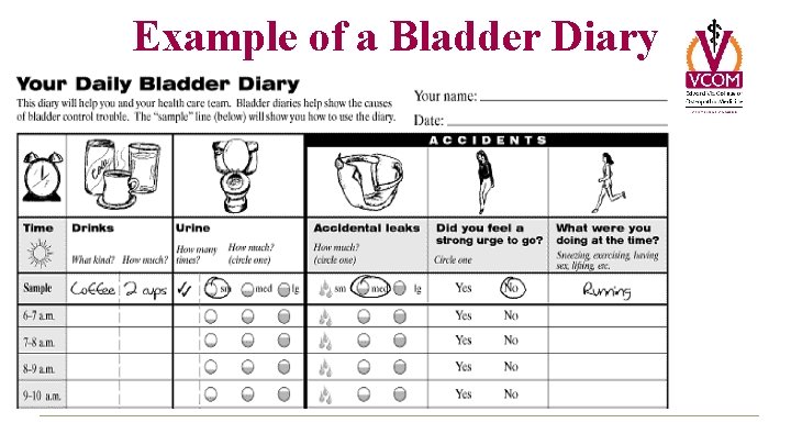 Example of a Bladder Diary 