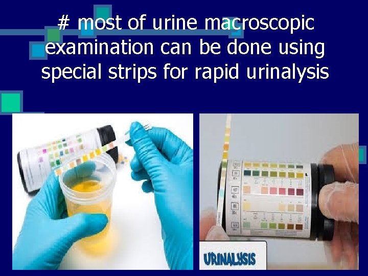 # most of urine macroscopic examination can be done using special strips for rapid