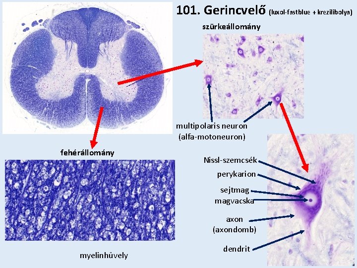 101. Gerincvelő (luxol-fastblue + krezilibolya) szürkeállomány multipolaris neuron (alfa-motoneuron) fehérállomány Nissl-szemcsék perykarion sejtmag magvacska