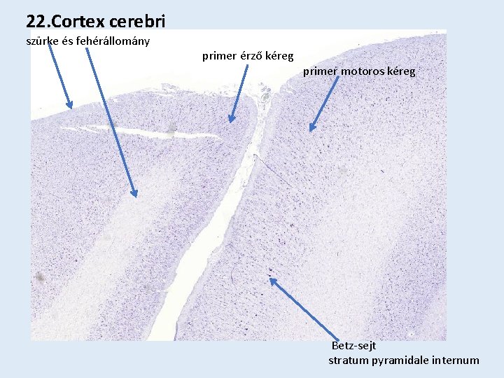 22. Cortex cerebri szürke és fehérállomány primer érző kéreg primer motoros kéreg Betz-sejt stratum