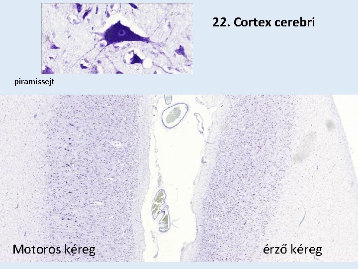 22. Cortex cerebri piramissejt Motoros kéreg érző kéreg 