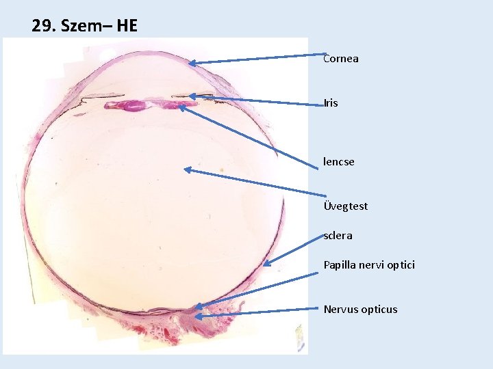 29. Szem– HE Cornea Iris lencse Üvegtest sclera Papilla nervi optici Nervus opticus 