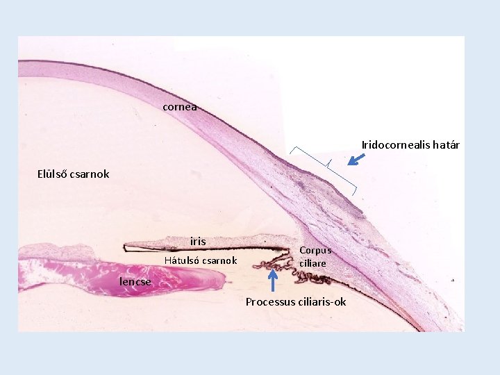 cornea Iridocornealis határ Elülső csarnok iris Hátulsó csarnok Corpus ciliare lencse Processus ciliaris-ok 