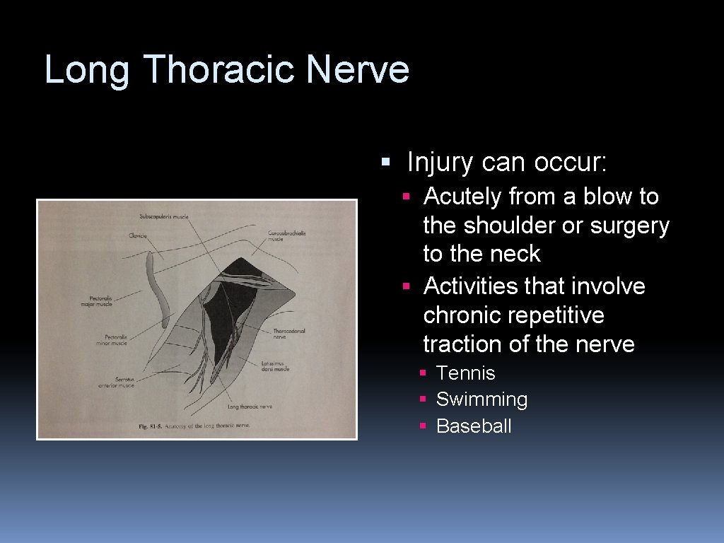 Long Thoracic Nerve § Injury can occur: § Acutely from a blow to the