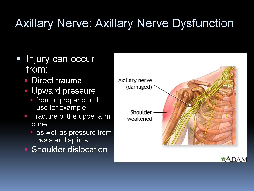 Axillary Nerve: Axillary Nerve Dysfunction § Injury can occur from: § Direct trauma §