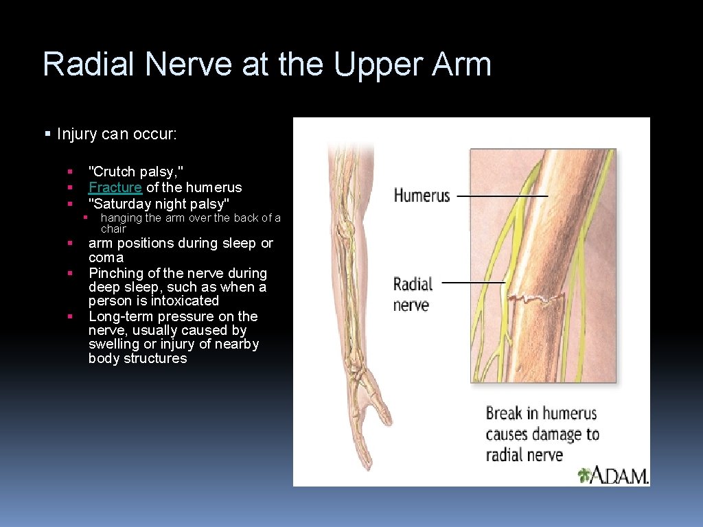Radial Nerve at the Upper Arm § Injury can occur: § § § "Crutch