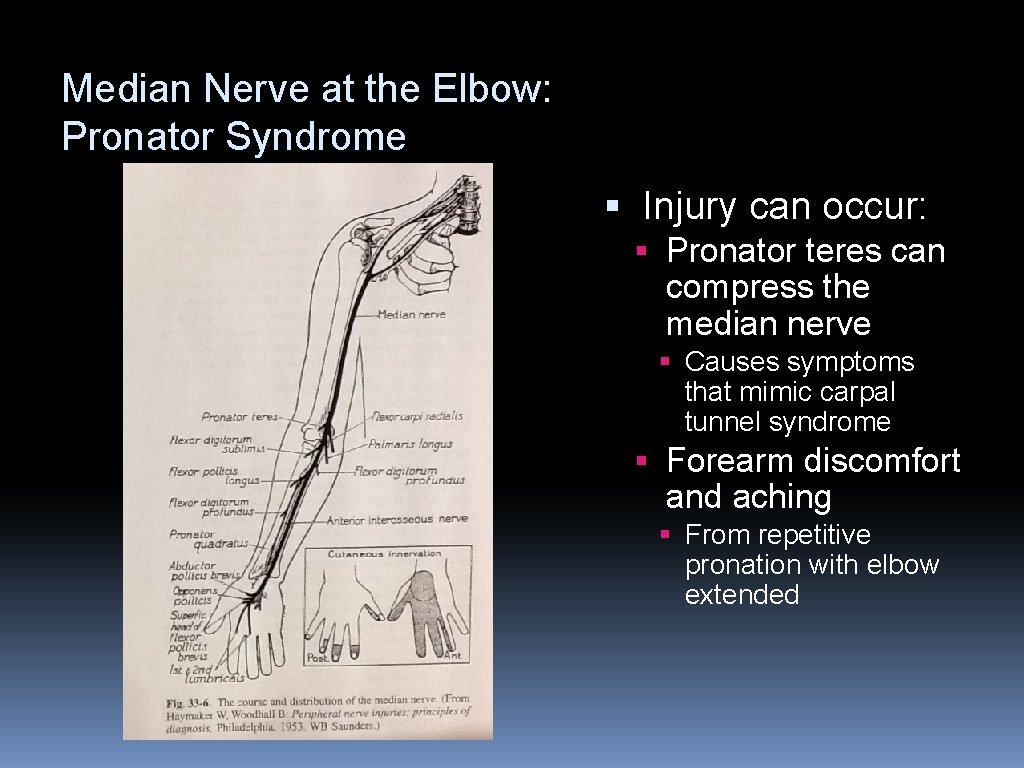 Median Nerve at the Elbow: Pronator Syndrome § Injury can occur: § Pronator teres