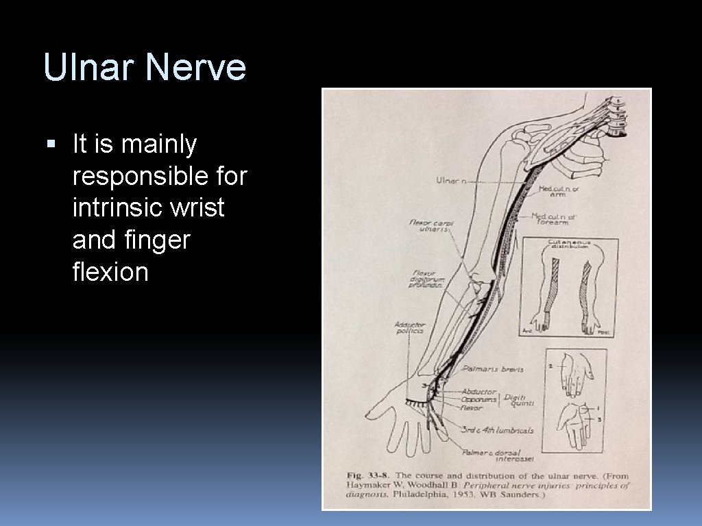 Ulnar Nerve § It is mainly responsible for intrinsic wrist and finger flexion 