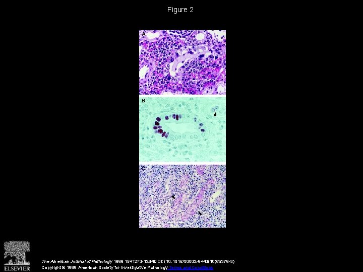 Figure 2 The American Journal of Pathology 1999 1541273 -1284 DOI: (10. 1016/S 0002