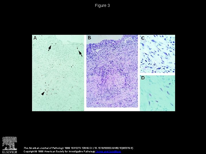 Figure 3 The American Journal of Pathology 1999 1541273 -1284 DOI: (10. 1016/S 0002