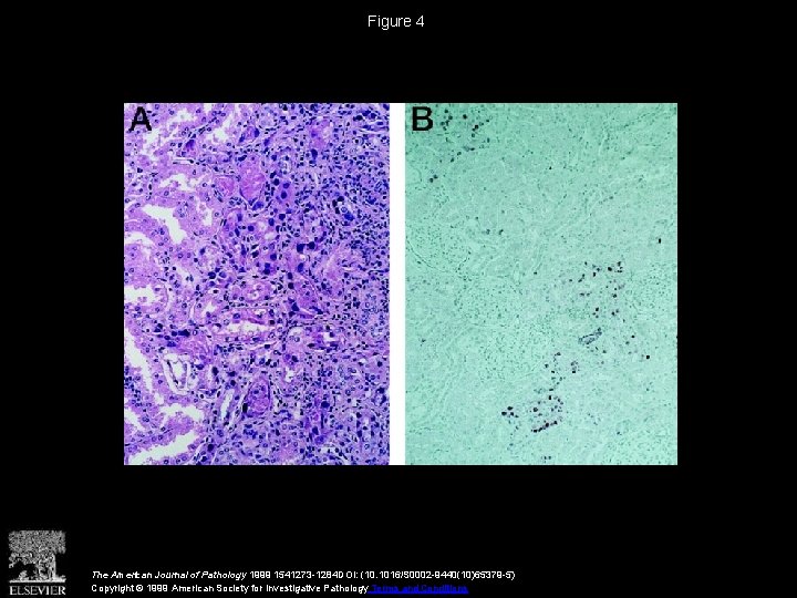 Figure 4 The American Journal of Pathology 1999 1541273 -1284 DOI: (10. 1016/S 0002