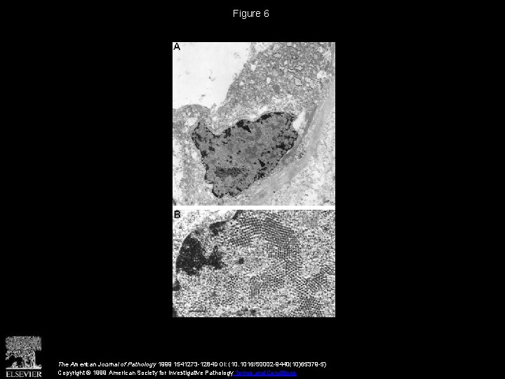 Figure 6 The American Journal of Pathology 1999 1541273 -1284 DOI: (10. 1016/S 0002