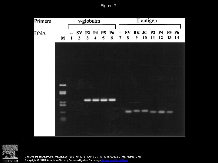 Figure 7 The American Journal of Pathology 1999 1541273 -1284 DOI: (10. 1016/S 0002